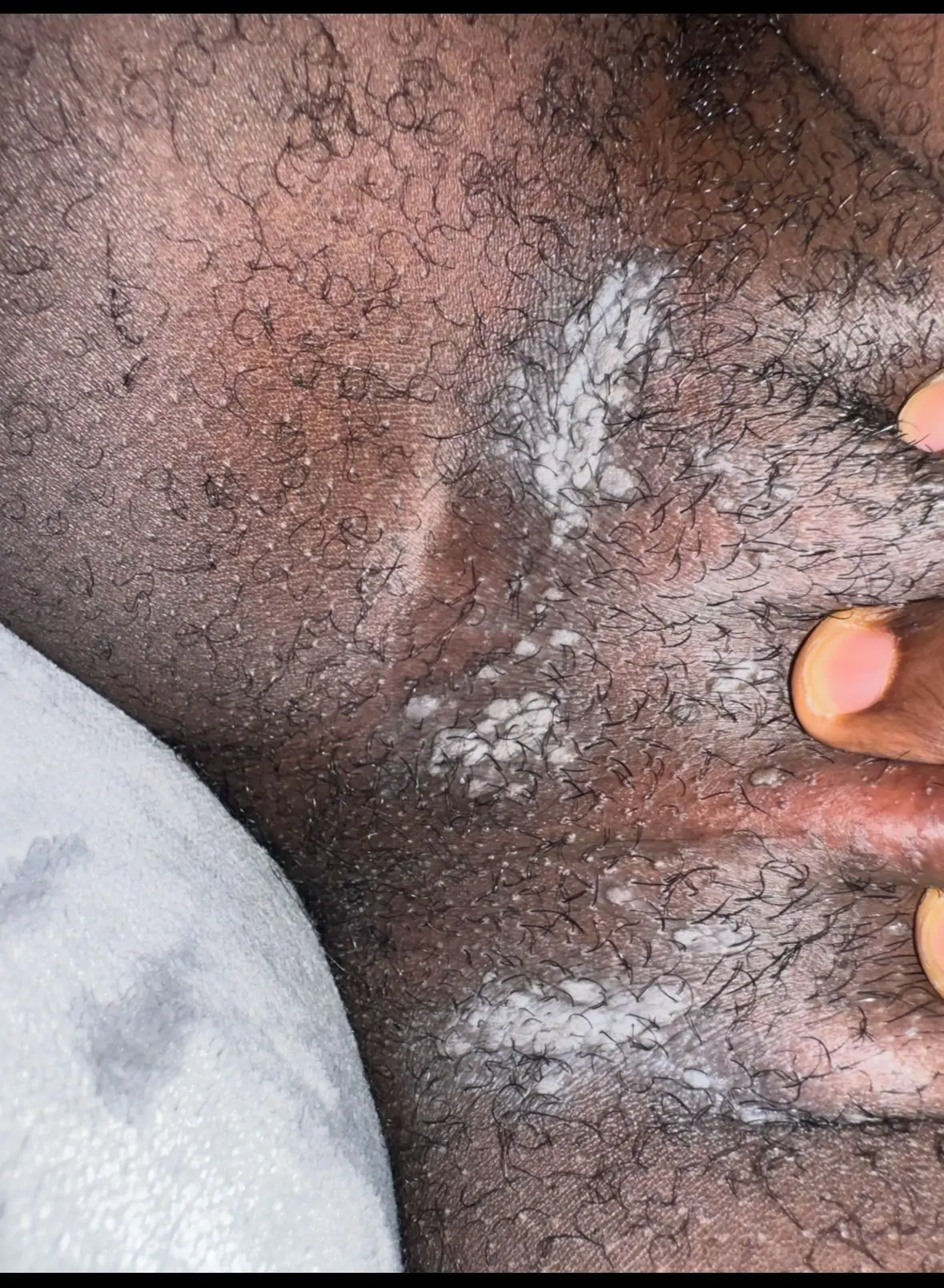 🌿 Healing Story: How COA PLUS Helped with My Herpes/Warts Struggles